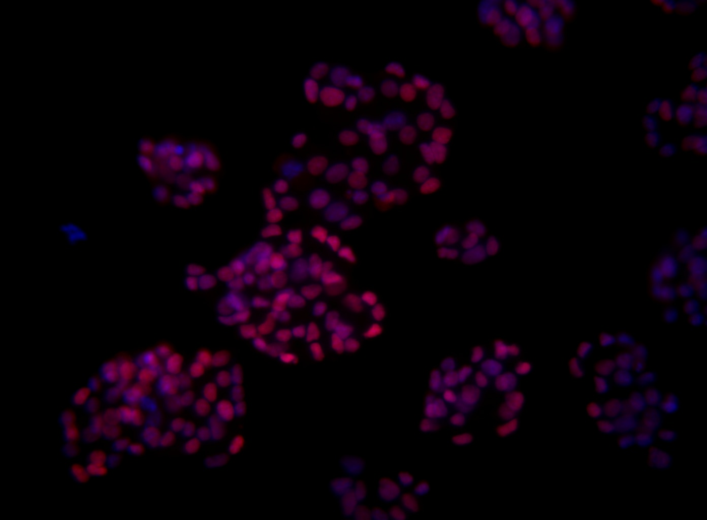 Nkx6-1-A647_-_Imaging_Figure_for_TDS.png